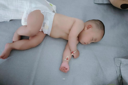 锡林郭勒盟宝宝脸上有白色斑块